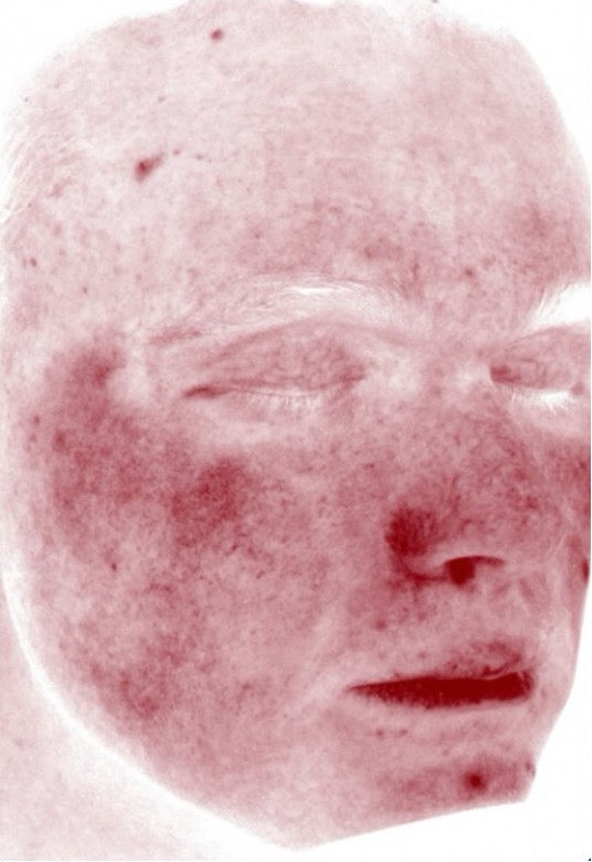 After image