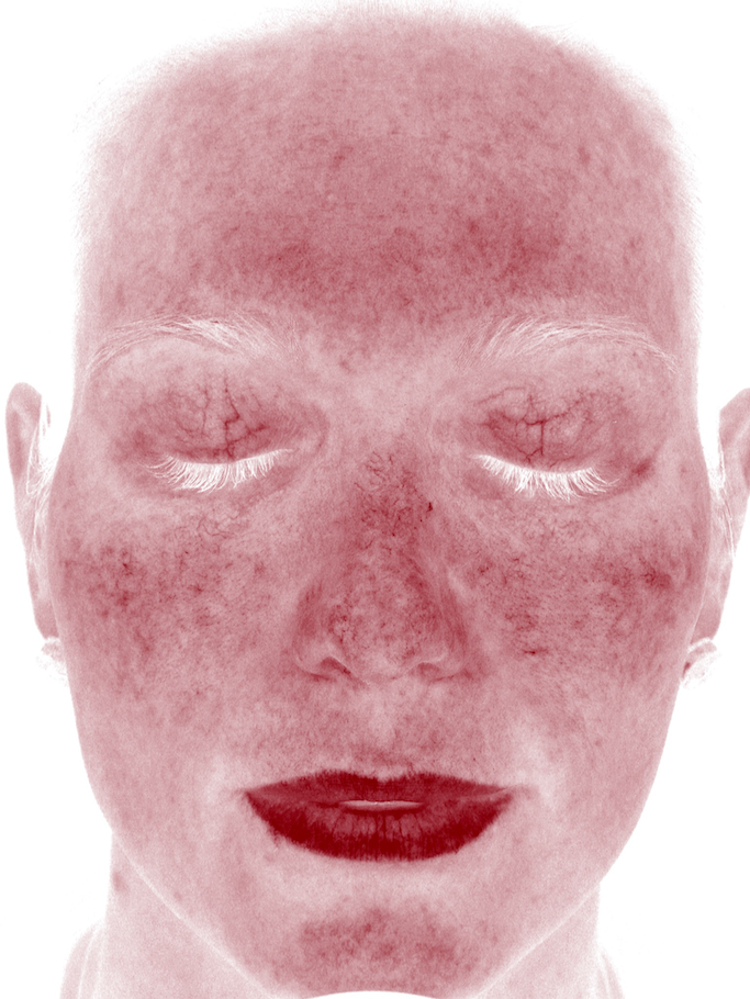 After image