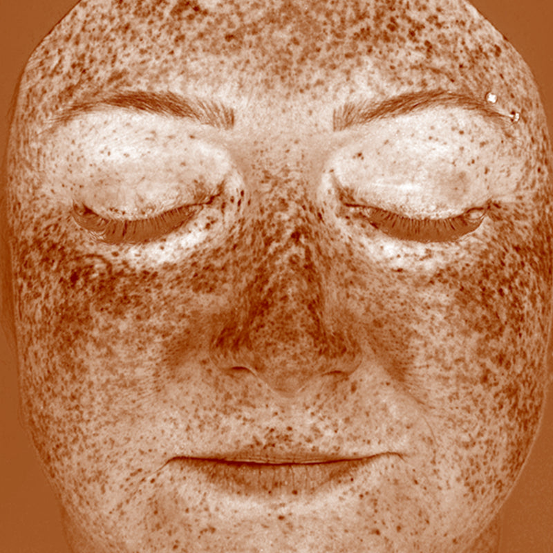 After image