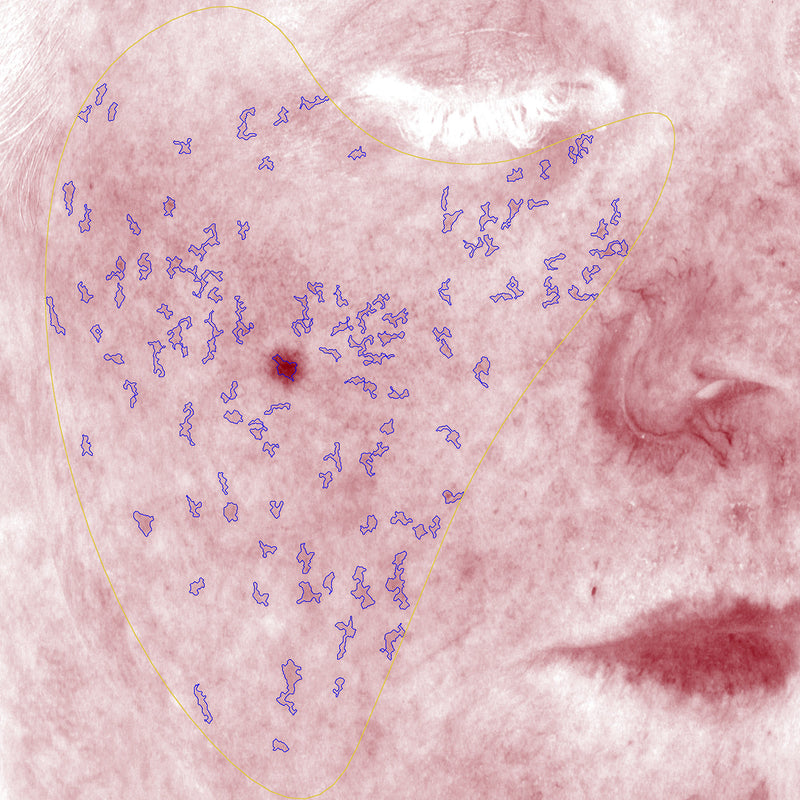 After image